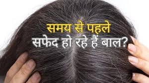 Amla Powder: Hair Growth Aur Skin Care Ka Ayurvedic Powerhouse!